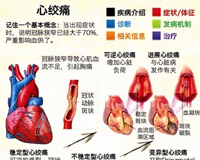 如何来预防心机缺血(图1)